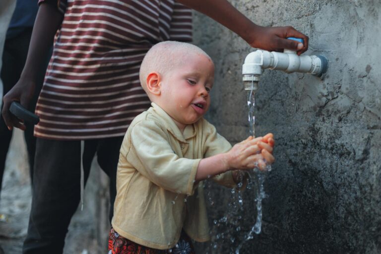An albino child washing hands at an outdoor faucet, showcasing hygiene and water access in Nigeria.